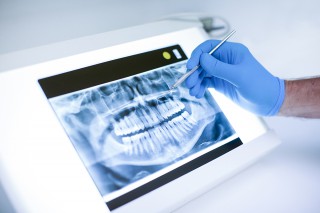 Panoramica digitale extraorale Ortopantomografia Studio Bianconi dentista Bolzano